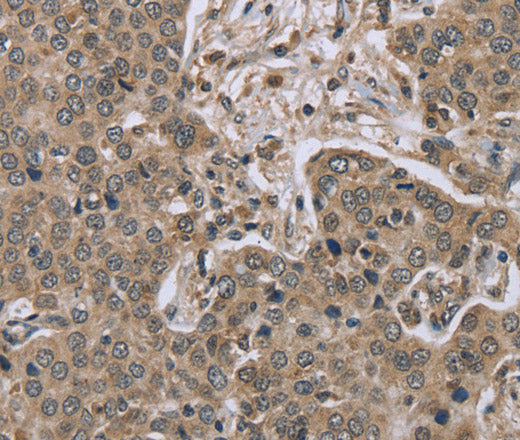 Anti-Human/Mouse IL15RA Antibody - ABMIUM
