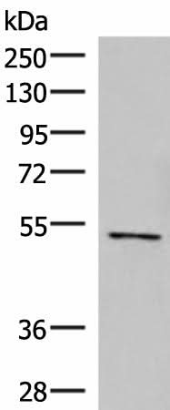 Western blot analysis of Jurkat cell lysate using POLD2 Polyclonal Antibody at dilution of 1:800