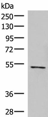 Western blot analysis of Jurkat cell lysate using POLD2 Polyclonal Antibody at dilution of 1:800