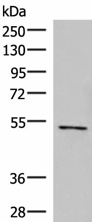Western blot analysis of Jurkat cell lysate using POLD2 Polyclonal Antibody at dilution of 1:800