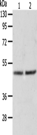 Anti-Human/Mouse/Rat AGXT Antibody - ABMIUM