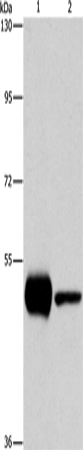 Anti-Human/Mouse/Rat PIP4K2A Antibody - ABMIUM