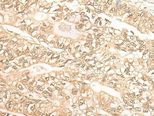 Anti-Human/Mouse DMC1 Antibody