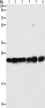 Anti-Human/Mouse/Rat SIGMAR1 Antibody - ABMIUM
