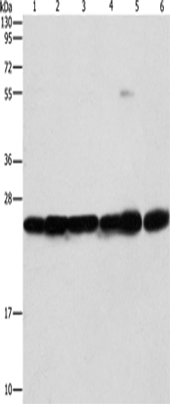 Anti-Human/Mouse/Rat SIGMAR1 Antibody - ABMIUM