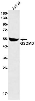 Western blot detection of GSDMD in Jurkat cell lysates using GSDMD Rabbit mAb(1:500 diluted).Predicted band size:53kDa.Observed band size:53kDa.