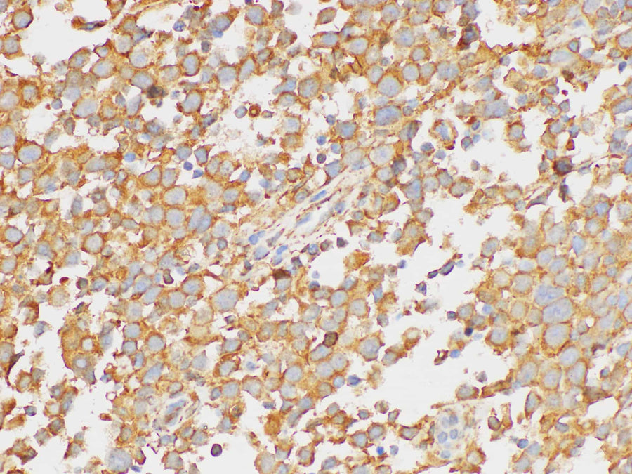 Immunohistochemistry of paraffin-embedded Human testis using PAIP1 Polycloanl Antibody at dilution of 1:200.