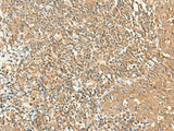 Immunohistochemistry of paraffin-embedded Human tonsil tissue using GRIPAP1 Polyclonal Antibody at dilution of 1:50(×200)