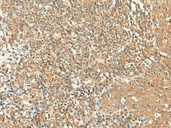 Anti-Human/Mouse/Rat GRIPAP1 Antibody