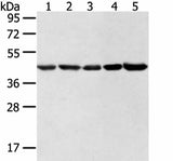Western blot analysis of Hela lncap NIH/3T3 K562 and 231 cell using WDR77 Polyclonal Antibody at dilution of 1:500