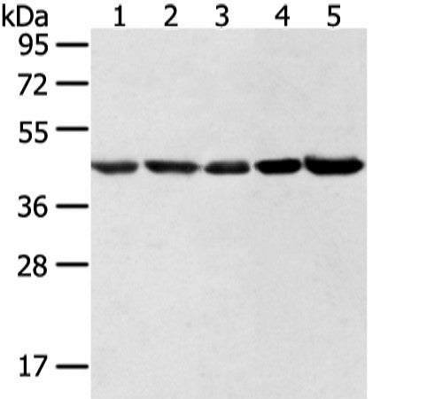 Western blot analysis of Hela lncap NIH/3T3 K562 and 231 cell using WDR77 Polyclonal Antibody at dilution of 1:500