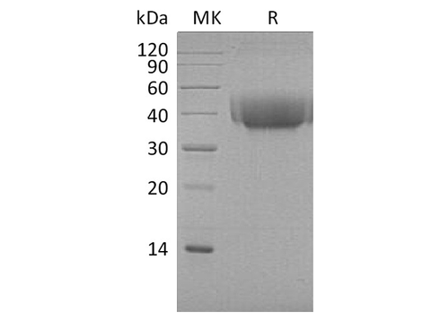 Recombinant Cynomolgus B7-1/CD80 Protein (His Tag) - ABMIUM