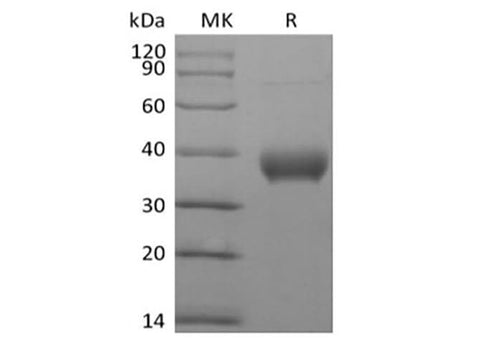 Recombinant Human Butyrophilin Subfamily 1 Member A1/BTN1A1 (C-6His-Avi) Biotinylated - ABMIUM