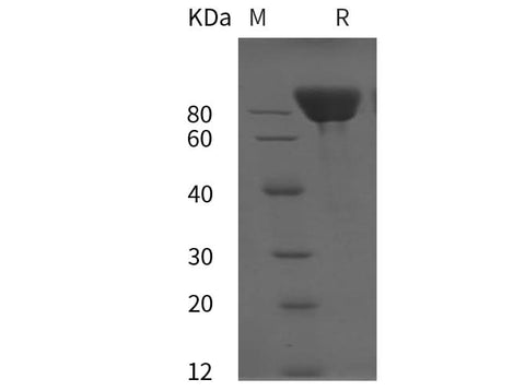 SDS-PAGE analysis of Rat E-Cadherin/CDH1 proteins, 2 μg/lane of Recombinant Rat E-Cadherin/CDH1 proteins was resolved with SDS-PAGE under reducing conditions, showing bands at 80 kDa.