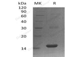 Recombinant Human PLA2G16 Protein (His Tag) - ABMIUM