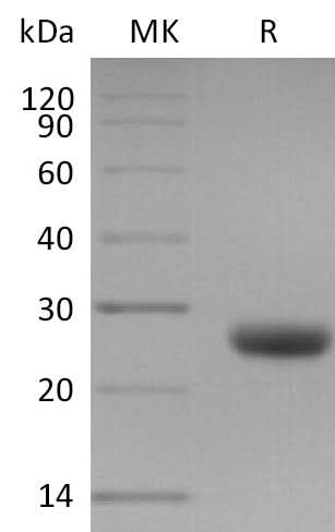 Recombinant Mouse TIMP1/TIMP Protein - ABMIUM