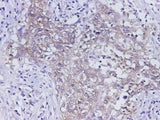 Anti-Human EpCAM Antibody - ABMIUM