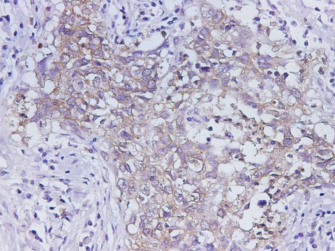 Anti-Human EpCAM Antibody - ABMIUM