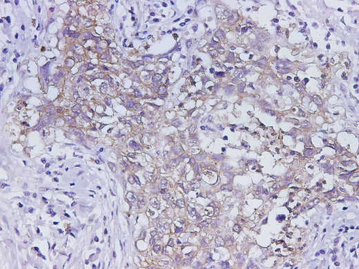 Anti-Human EpCAM Antibody - ABMIUM