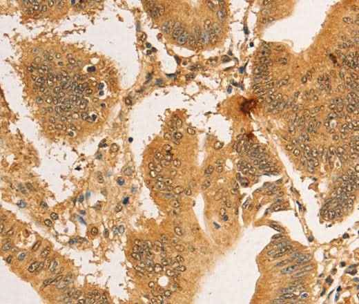 Anti-Human RPL26L1 Antibody