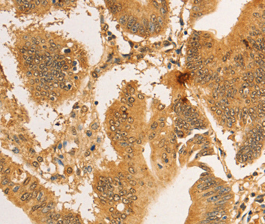 Anti-Human RPL26L1 Antibody - ABMIUM