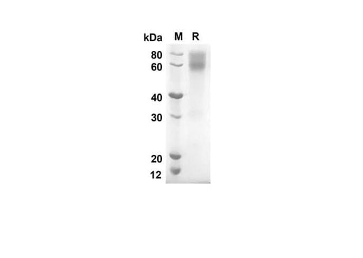 SDS-PAGE analysis of Mouse CD80/B7-1 proteins, 2 μg/lane of Recombinant Mouse CD80/B7-1 proteins was resolved with an SDS-PAGE under reducing conditions, showing bands at 47.9 kDa.