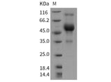 > 76 % as determined by reducing SDS-PAGE.