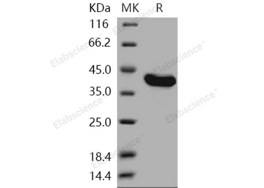 > 98 % as determined by reducing SDS-PAGE.