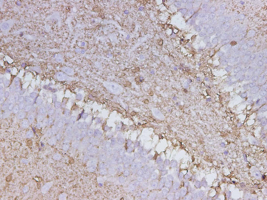 Anti-Mouse/Rat S100B Antibody - ABMIUM