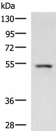 Western blot analysis of Rat liver tissue lysate using ONECUT1 Polyclonal Antibody at dilution of 1:600