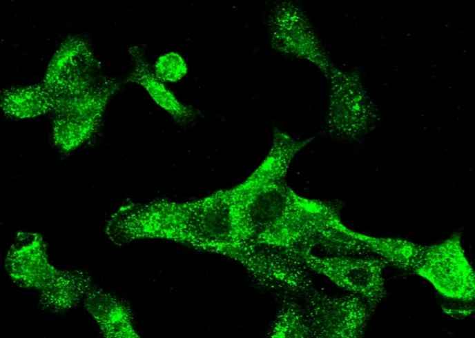 Anti-Human KRT5 Antibody [A1222] - ABMIUM
