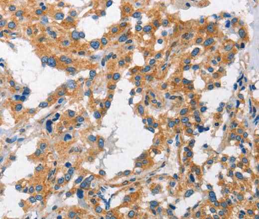Anti-Human/Mouse CHMP1A Antibody