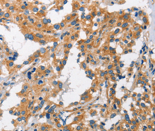 Anti-Human/Mouse CHMP1A Antibody - ABMIUM
