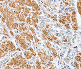 Anti-Human CENPC Antibody - ABMIUM