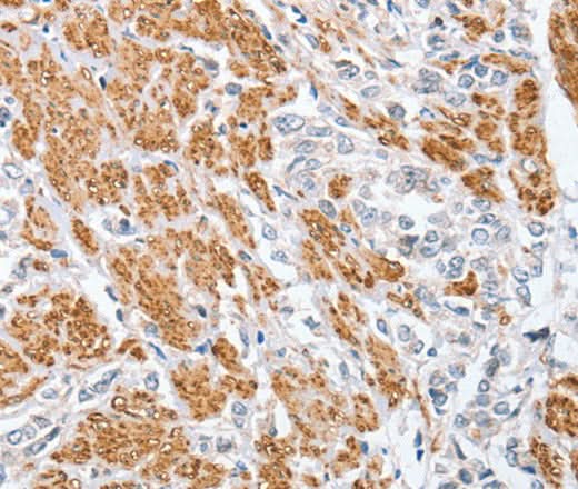 Anti-Human CENPC Antibody - ABMIUM