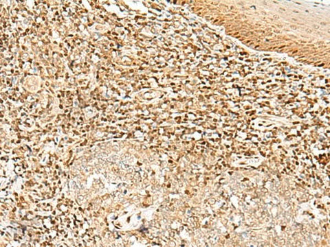 Immunohistochemistry of paraffin-embedded Human tonsil tissue using DNPEP Polyclonal Antibody at dilution of 1:30(×200)