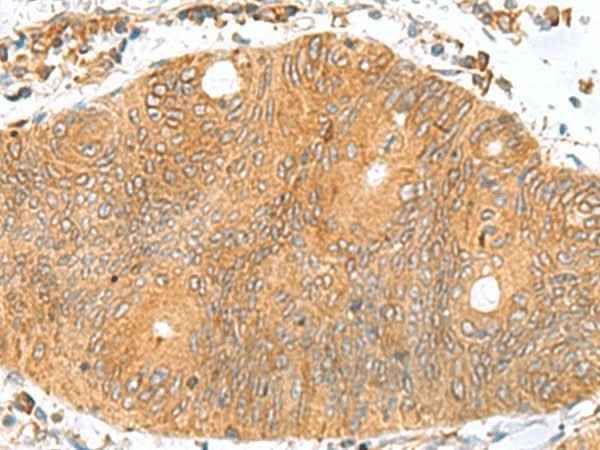 Anti-Human/Mouse/Rat TXNDC12 Antibody