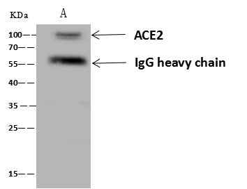 Anti-Human ACE2 Antibody [A1136] - ABMIUM