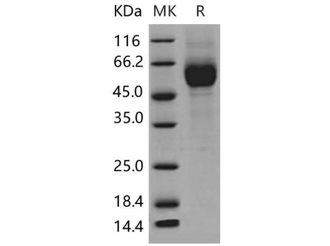 Recombinant Mouse IL1R1/CD121a Protein (His Tag) - ABMIUM