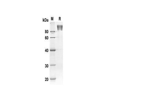 SDS-PAGE analysis of Human AXL/UFO proteins , 2 μg/lane of Recombinant Human AXL/UFO proteins was resolved with SDS-PAGE under reducing conditions , showing bands at 90-100 kDa.