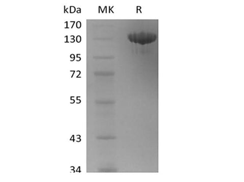 Recombinant Human Tie-2 (C-Fc) - ABMIUM