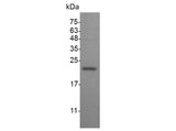 Recombinant Mouse IFN alpha 1a protein(His Tag) - ABMIUM