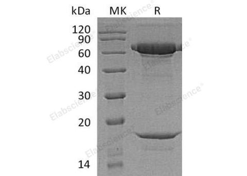 Recombinant Human PCSK9 Protein (His Tag/HA/AVI) - ABMIUM