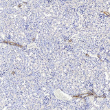 Immunohistochemistry (antigen was repair with 0.4% pepsin for 20 min) analysis of paraffin-embedded Mouse kidney using COL1A1 Polyclonal Antibody at dilution of 1:500.