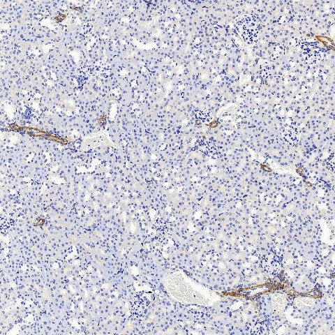 Immunohistochemistry (antigen was repair with 0.4% pepsin for 20 min) analysis of paraffin-embedded Mouse kidney using COL1A1 Polyclonal Antibody at dilution of 1:500.