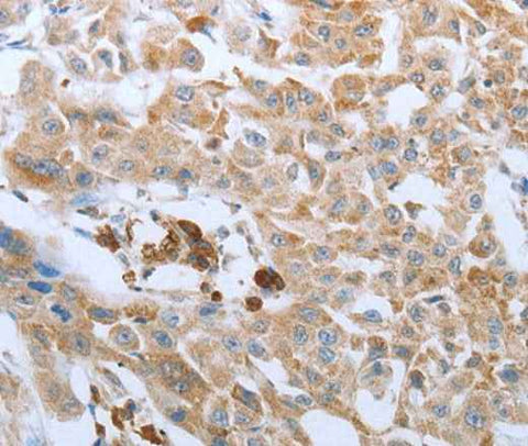Anti-Human/Mouse/Rat FGF1 Antibody