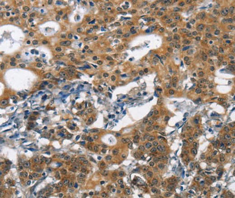 Anti-Human/Mouse/Rat DCC Antibody - ABMIUM