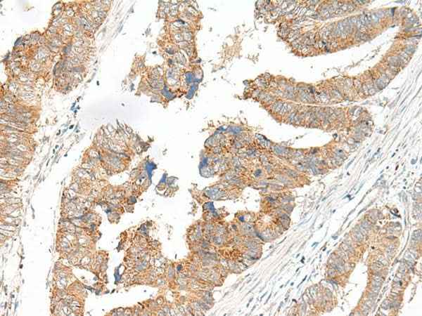 Anti-Human/Mouse/Rat SLC6A9 Antibody