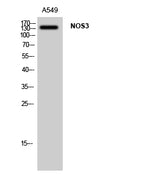 Western Blot analysis of A549 cells using NOS3 Polyclonal Antibody at dilution of 1:1000.