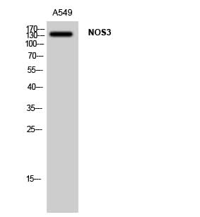 Western Blot analysis of A549 cells using NOS3 Polyclonal Antibody at dilution of 1:1000.